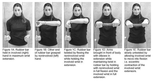 Tennis Elbow: Lateral and Medial Epicondylitis